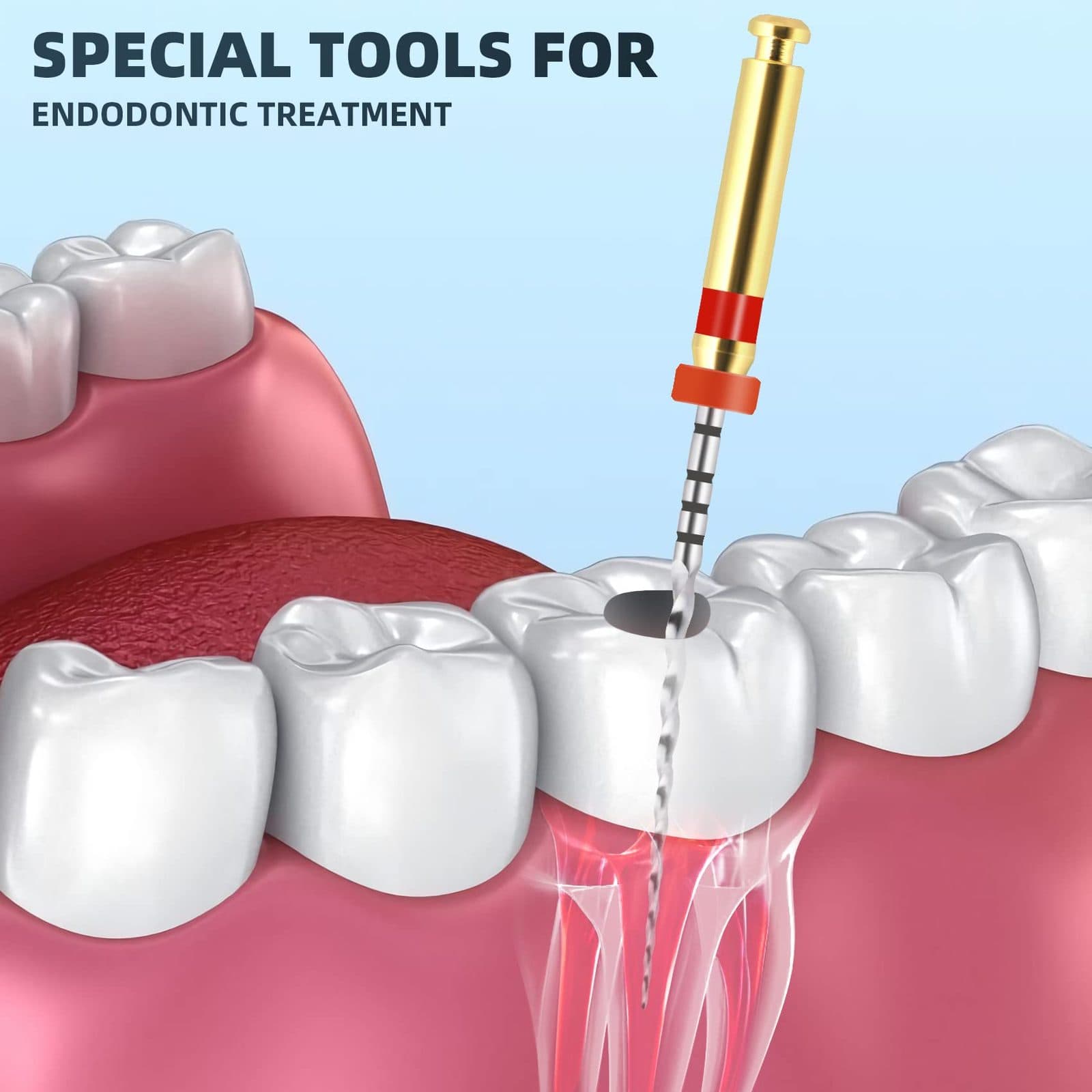Trâm máy ProTaper Universal | Dentsply Mỹ