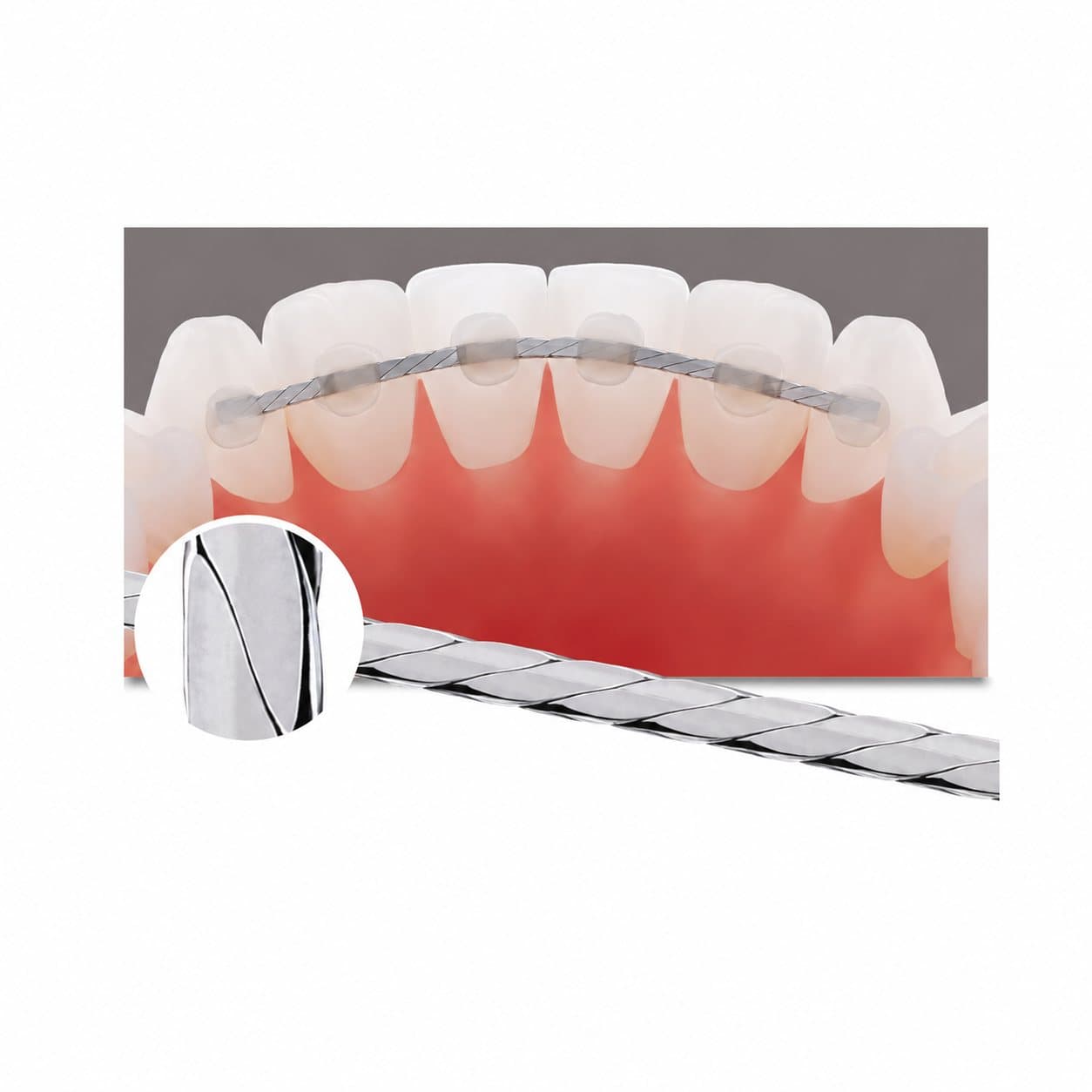 Dây duy trì dẹt American Orthodontic 