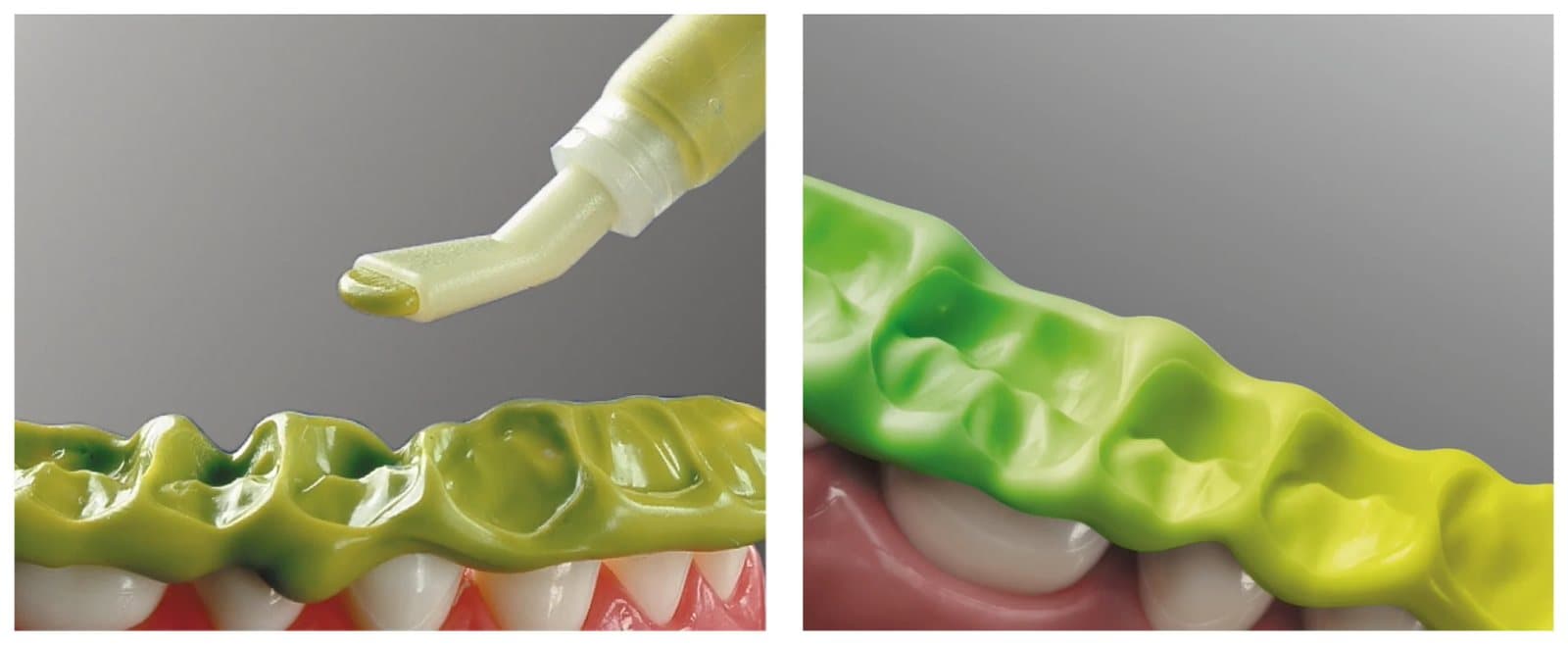 Cao su lấy dấu cắn Greenbite Apple Detax