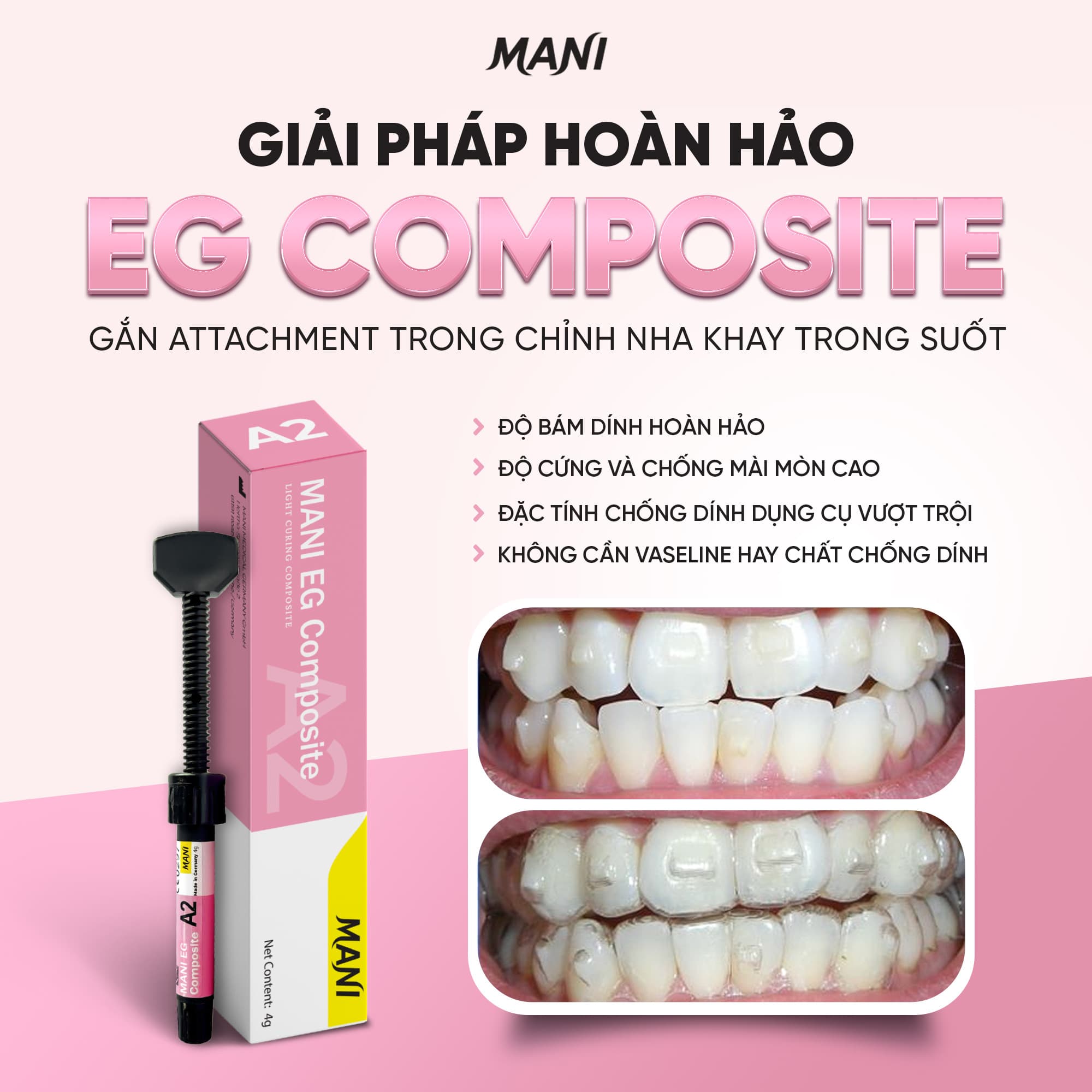 Composite Đặc Mani EG Mani Nhật Bản