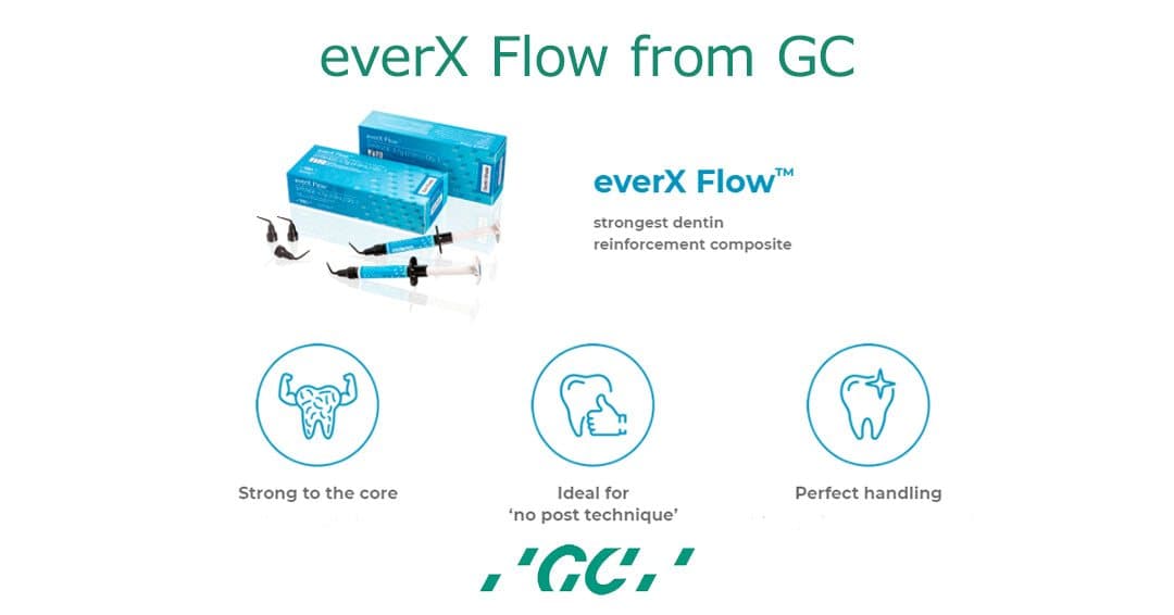 Composite sợi dạng lỏng EverX Flow thay thế ngà răng - GC