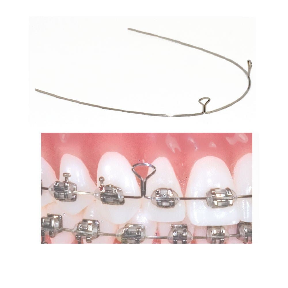 Dây Keyhole Loop TruForce Stainless Steel Retraction 2 keyhole - Ortho Technology
