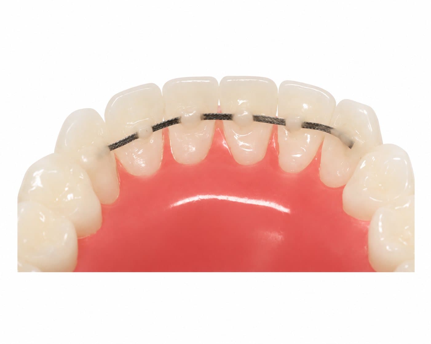Dây thẳng SS - American Orthodontics