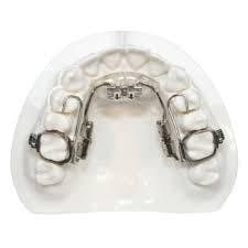 Khâu 3 ống để gắn TPA - Ortho Technology