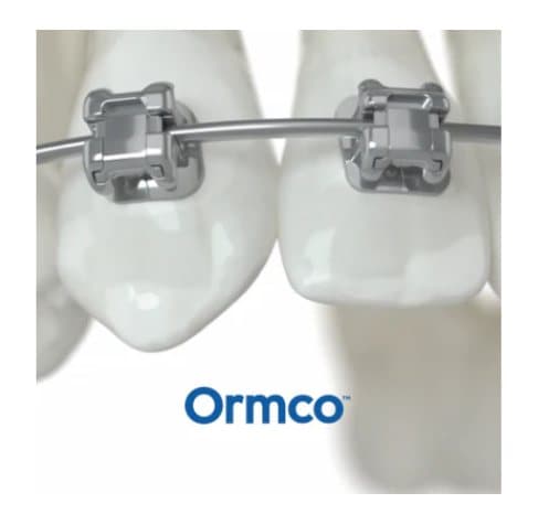 Mắc cài Damon Ultima