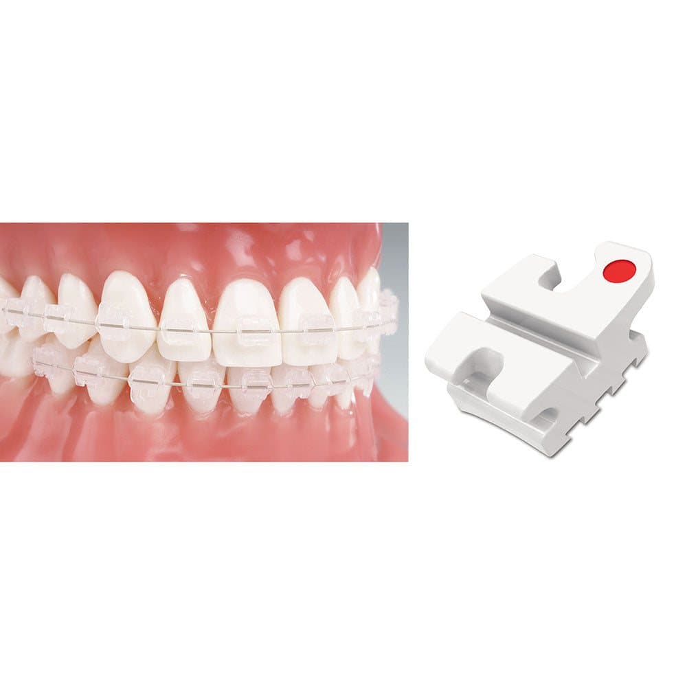 Mắc cài sứ thẩm mỹ Reflection - Ortho Technology