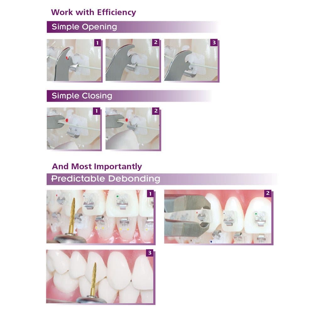Mắc cài sứ tự buộc SensationM - Ortho Technology