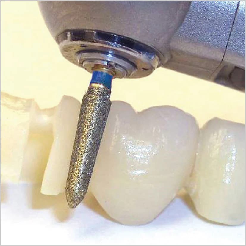 Mũi xuyên sứ Magic Touch Strauss Israel