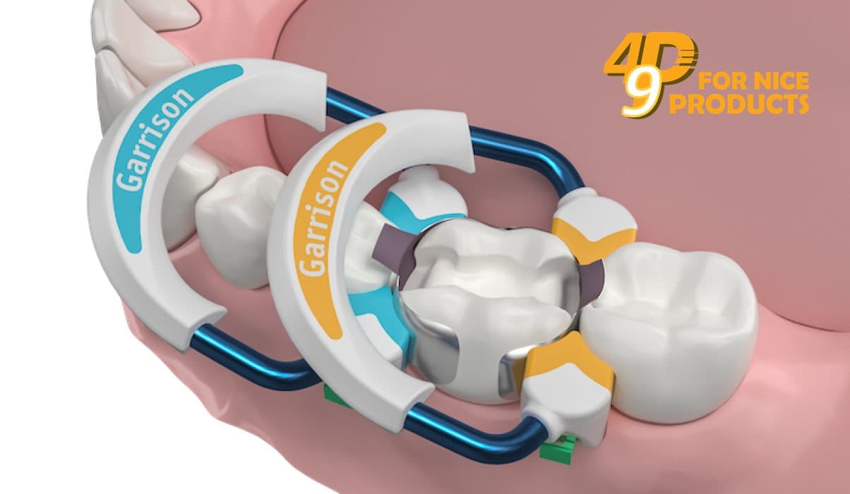 Vòng giữ khuôn trám Strata-G™ - Garrision