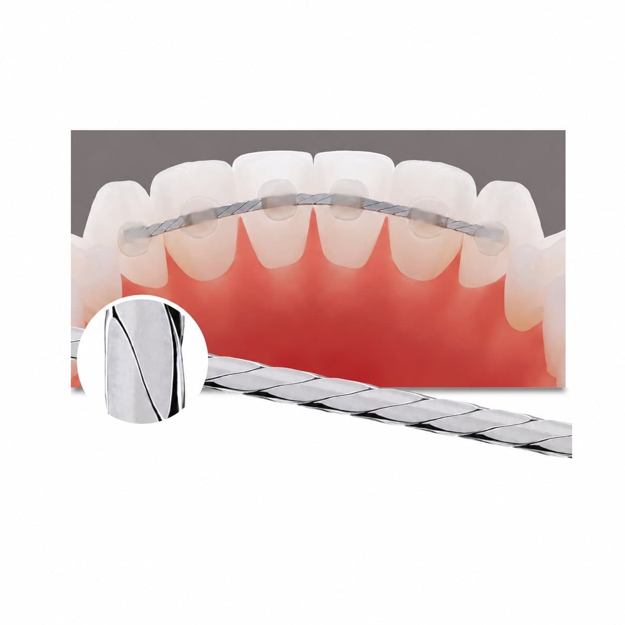 Dây duy trì dẹt American Orthodontic