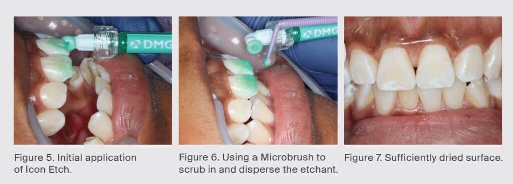 case-study-dieu-tri-dom-trang-icon-vestibular-etch-2