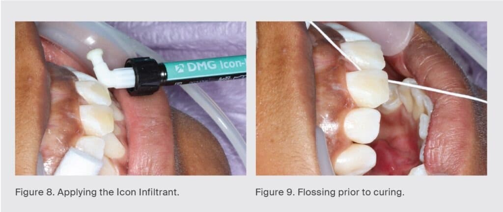 case-study-dieu-tri-dom-trang-icon-vestibular-etch-3